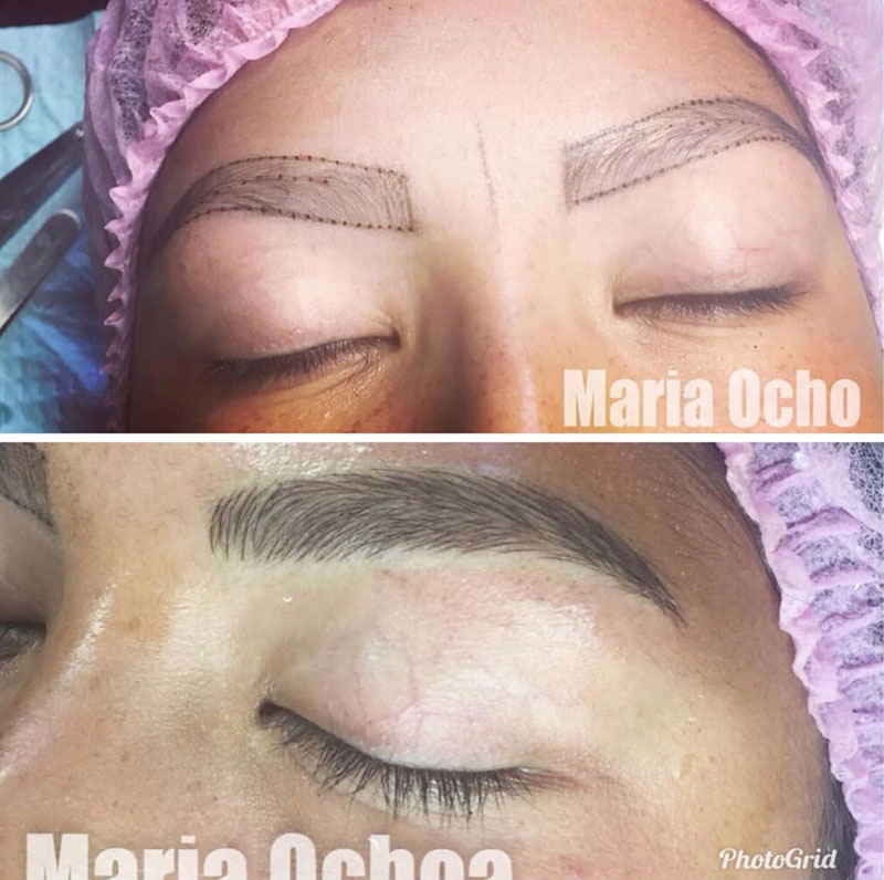 before-after-0001 before-after-0001