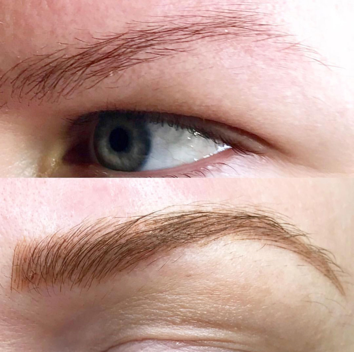 before-after-001 before-after-001